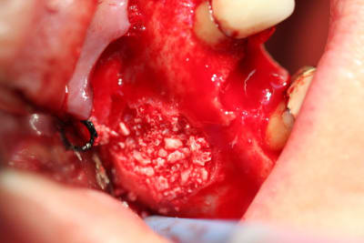 Jou 122 lx0hah - Eugenol