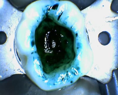 Kk 2014 04 08 174128 clload - Eugenol