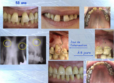 Kolpins ef29kq - Eugenol
