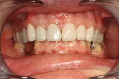 Lamothe france 001 on8gsg - Eugenol