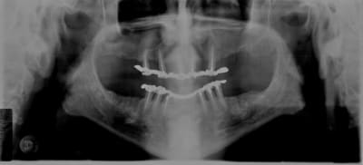 Las  7  1989 j03j47 - Eugenol