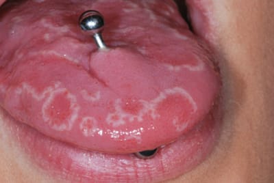 Lefranc090227192600all g  gpkhig - Eugenol