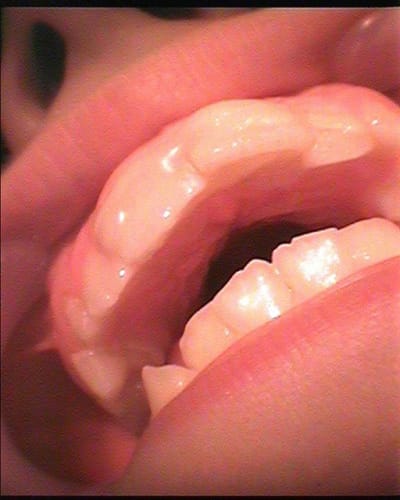 Leo 1 clduea - Eugenol