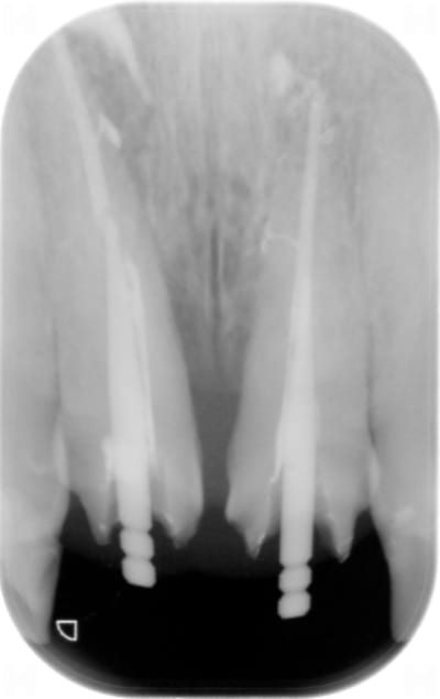 Lj xl8u6s - Eugenol