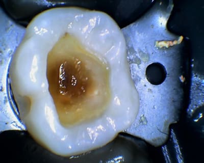 Ll 2014 04 08 173938 rmaavr - Eugenol
