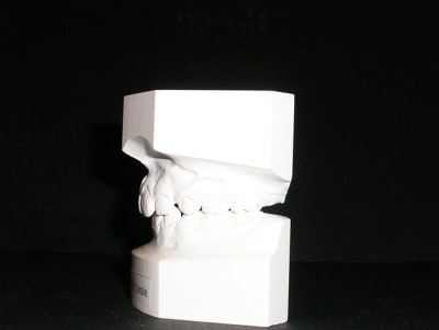 Le j c moulage gauche hl2vgq - Eugenol