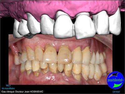 Mci - Eugenol