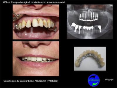 Mci mise en charge imm diate 002 kwvdh6 - Eugenol