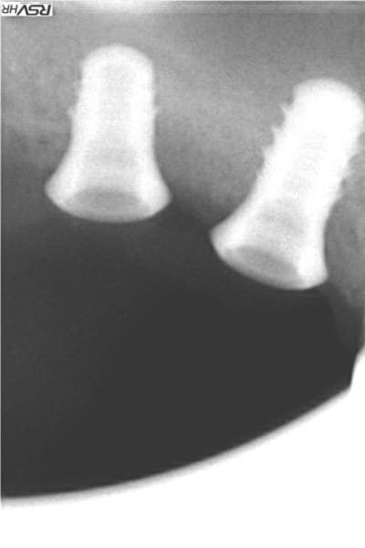 Meg1 wg3nxm - Eugenol