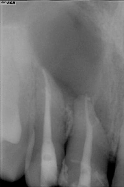 Mr3 szf2b4 - Eugenol