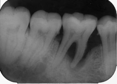 M paule 46  19 12 03 wjtoh0 - Eugenol