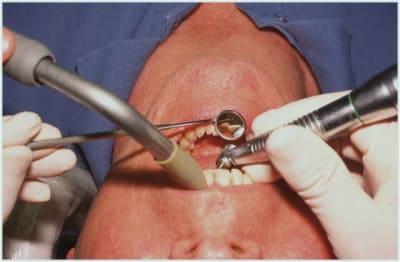 Miroir 2 ym6o49 - Eugenol