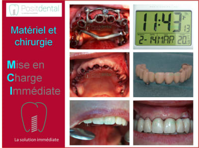 Mise en charge immédiate 009 a2sho3 - Eugenol