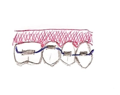 Numériser0001 tfom14 - Eugenol