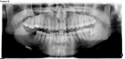 Opt dds a7clf7 - Eugenol