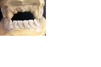 Occlusion de face u2kq2d - Eugenol