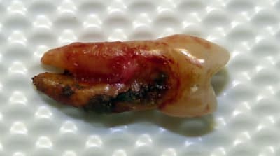 P1000160 fyumf1 - Eugenol