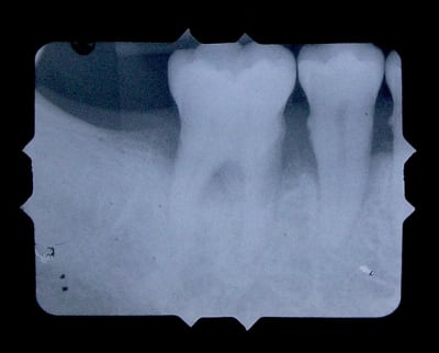 P1010012 zn1pra - Eugenol