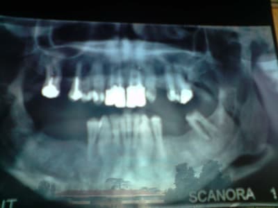 P101009 11 - Eugenol