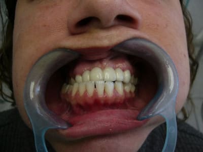 P1010502 egojcp - Eugenol