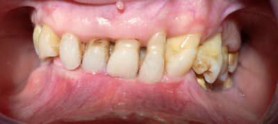 P1010887 ks0jhq - Eugenol