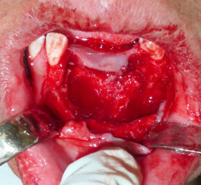 P1020573 l7q4re - Eugenol