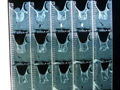 P1050009 r7aqov - Eugenol