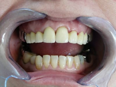 P1050986 nvlzgv - Eugenol