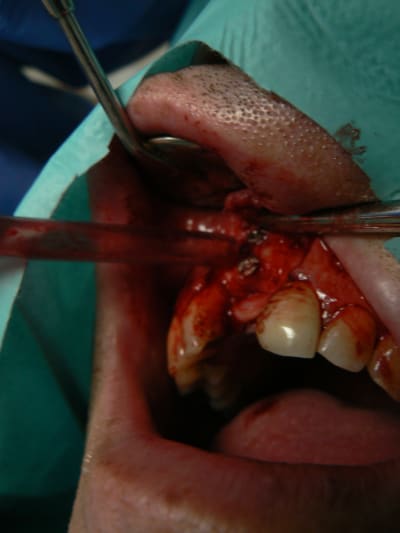 P1090039 zvyhiy - Eugenol