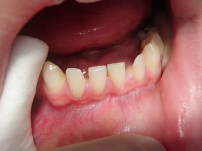 P1270023 ofv0mk - Eugenol