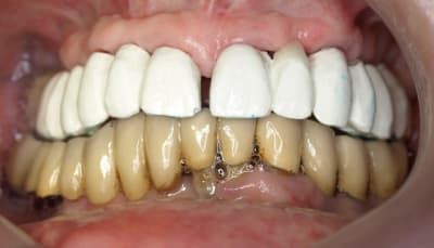 P6106708 zqhgw9 - Eugenol
