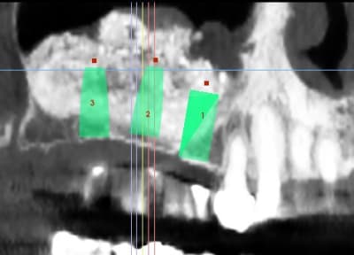 Pano aekssv - Eugenol