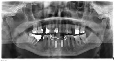Pano bdvtrl - Eugenol