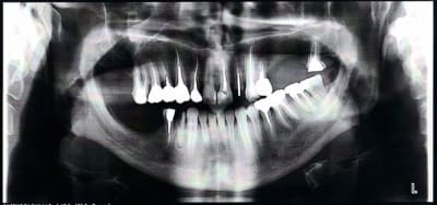 Pano ocxlyc - Eugenol