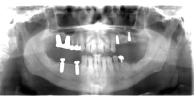 Pano wdwh22 - Eugenol