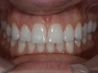 Pb070648 u1ejlm - Eugenol