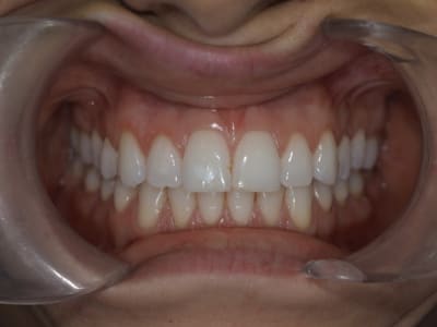 Pb070651 i8hyxt - Eugenol