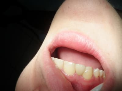 Pc220001 yewrw6 - Eugenol