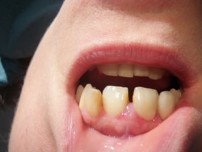 Pc220012 yydxnu - Eugenol