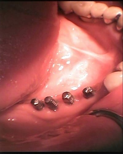 Photo2 yhcvwi - Eugenol