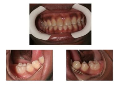 Photos cpapf6 - Eugenol
