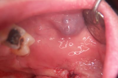 Photo 001 oqy6ue - Eugenol