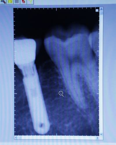 Pic00025 ek0b4z - Eugenol