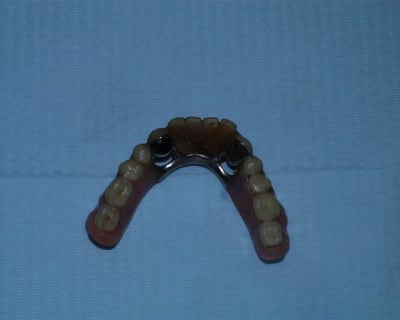 Pic00037 ptw9ib - Eugenol