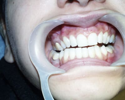 Pic00038 mqsvl8 - Eugenol