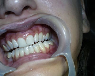 Pic00039 m6i9i0 - Eugenol