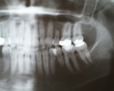 Pic00042 niymlk - Eugenol