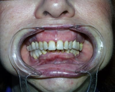 Pic00056 qlaelx - Eugenol