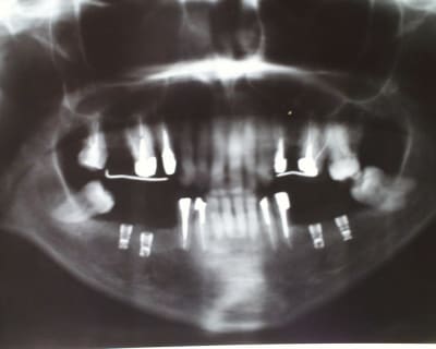 Pic00065 cqpi9a - Eugenol