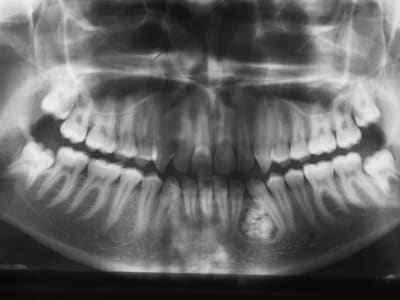 Pict0004 boydda - Eugenol